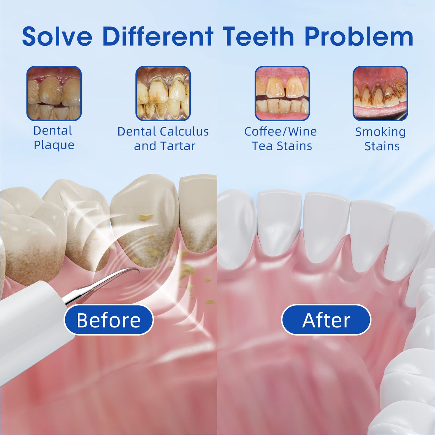 Ultrasonic tooth cleaner